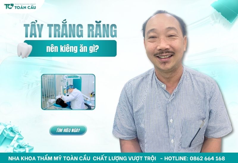 tẩy trắng răng nên kiêng gì