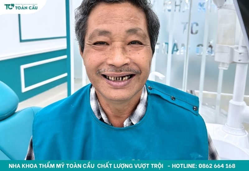 Trồng răng implant cho người cao tuổi có được hay không? 2 Trồng răng implant cho người cao tuổi