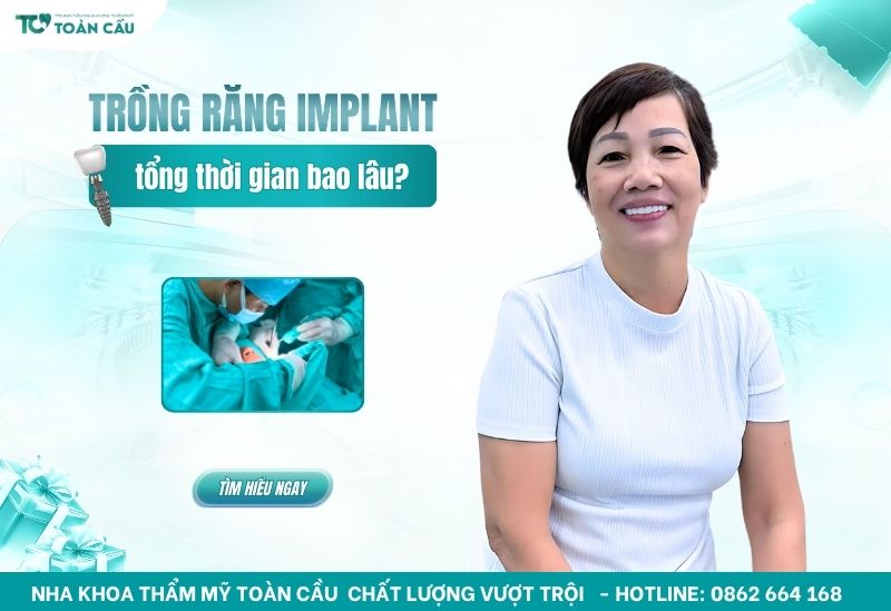 trồng răng implant mất bao lâu