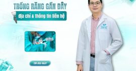 trồng răng ở gần đây