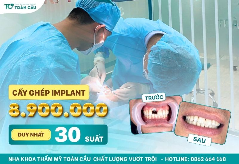 Địa chỉ trồng răng ở gần đây và thông tin liên hệ 5 Ưu đãi trồng răng tháng 8