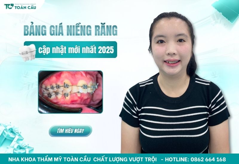 bảng giá niềng răng rẻ nhất
