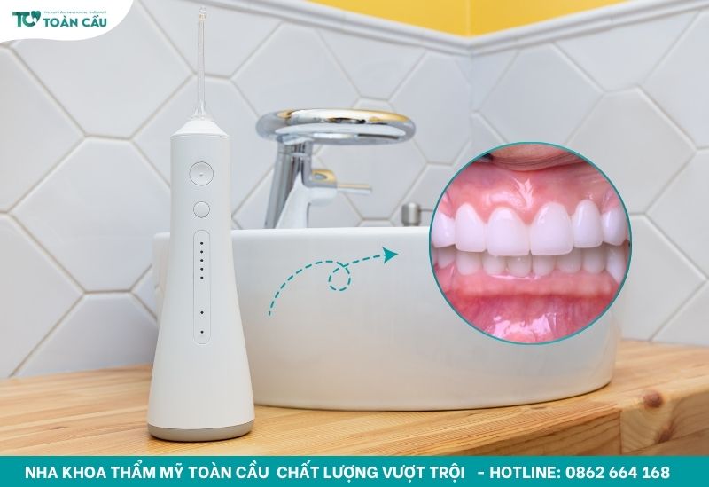 Răng bọc sứ có nên dùng tăm nước hay bàn chải là đủ? 2 Dùng tăm nước để làm sạch răng bọc sứ