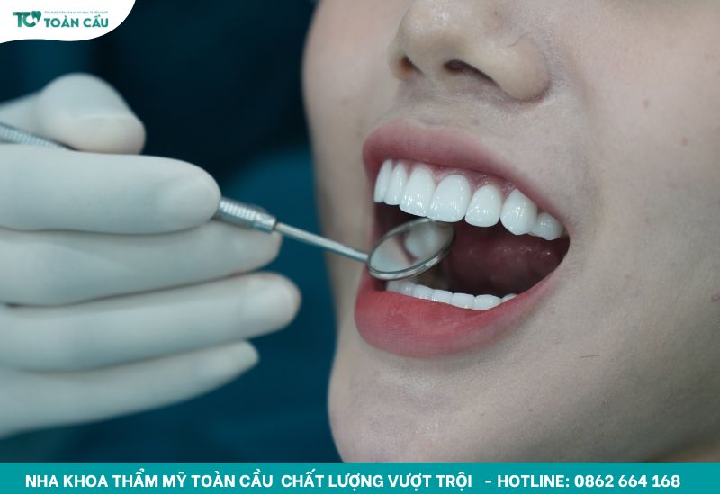 Bọc sứ không mài như thế nào và liệu có bền đẹp dài lâu? 6 Khách hàng xinh đẹp với bọc sứ không mài