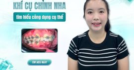 các loại khí cụ chỉnh nha