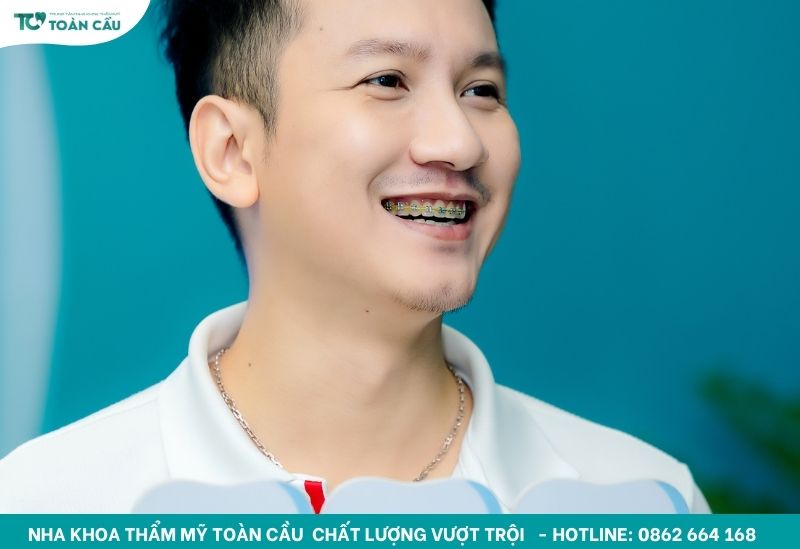 Các loại khí cụ chỉnh nha và công dụng cụ thể từng loại 2 Chỉnh nha cần nhiều khí cụ