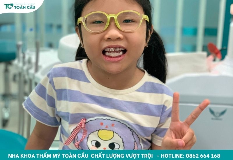 Các loại khí cụ chỉnh nha và công dụng cụ thể từng loại 8 Khách hàng nhí chỉnh nha tại Toàn Cầu