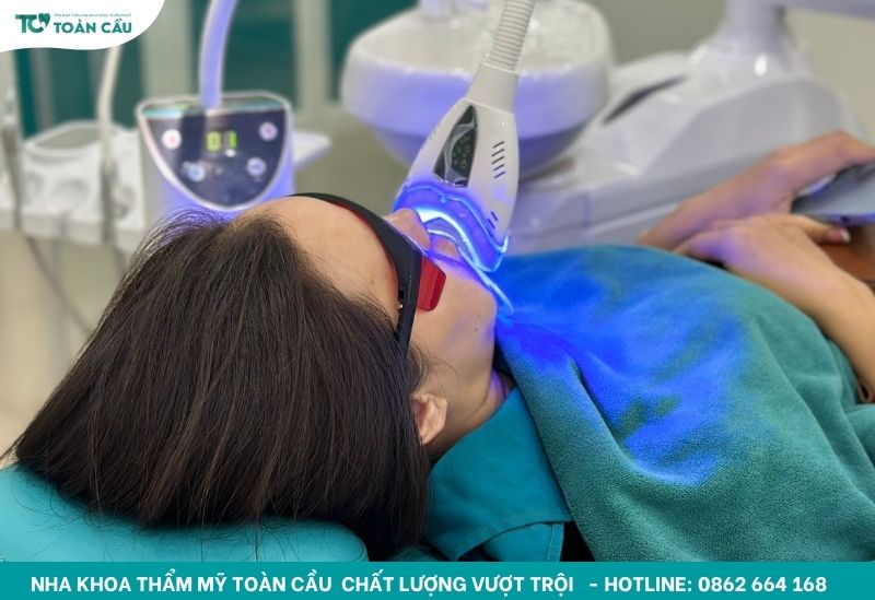 Cách làm trắng răng bị ố vàng lâu năm an toàn và hiệu quả 6 Công nghệ Laser Whitening hiện đại