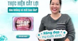 cắt lợi có đau không