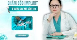 Chăm sóc răng sau khi trồng implant