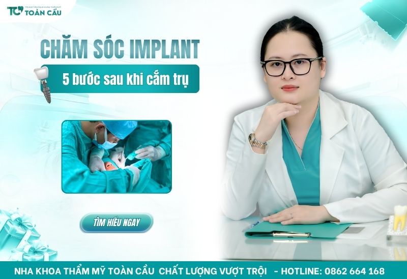 Chăm sóc răng sau khi trồng implant