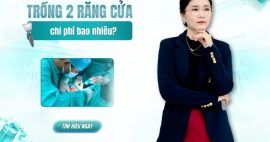 chi phí trồng 2 răng cửa