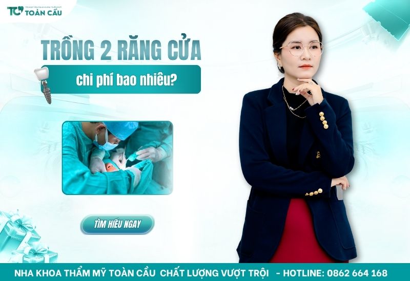 chi phí trồng 2 răng cửa