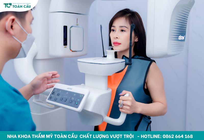 Dấu hiệu Implant bị đào thải mà bạn không nên chủ quan 6 Chụp CT Conebeam 3D
