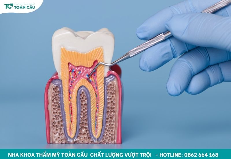 Dấu hiệu răng bị hư tuỷ và phương pháp điều trị an toàn 2 Tủy răng có thể bị tổn thương