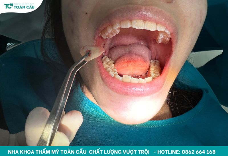 Nha Khoa Thẩm Mỹ Toàn Cầu