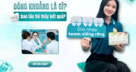 đóng khoảng trong niềng răng