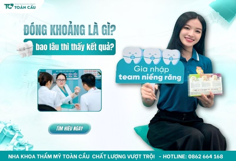 đóng khoảng trong niềng răng