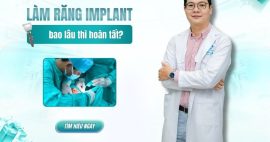 Làm răng Implant trong bao lâu