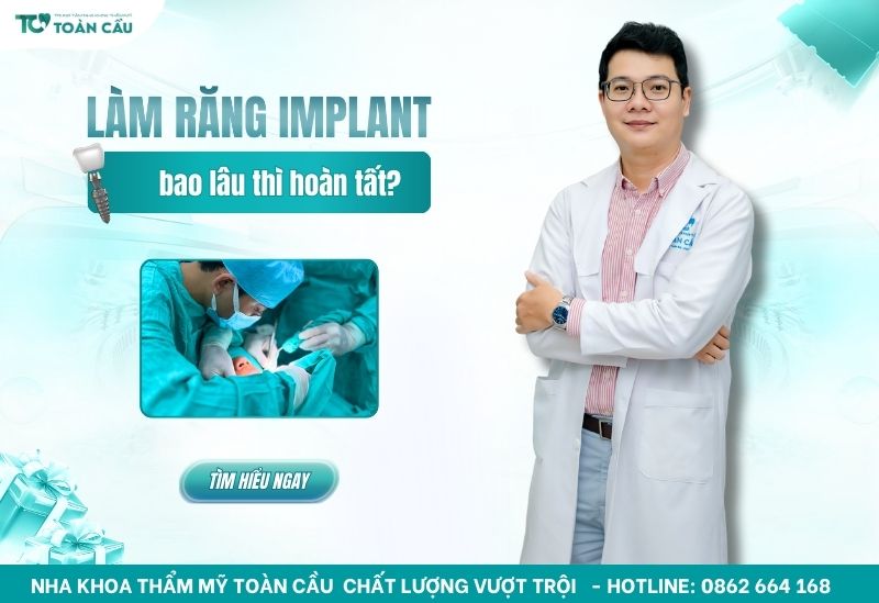 Làm răng Implant trong bao lâu