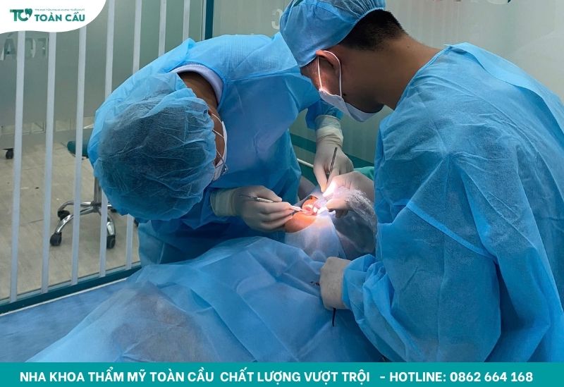 Làm răng Implant trong bao lâu thì hoàn tất? 2 Phẫu thuật đặt trụ Implant