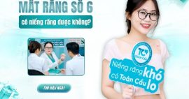 Bị mất răng số 6 hàm dưới có niềng răng được không?