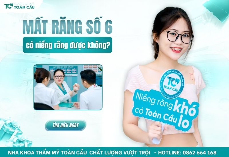 Bị mất răng số 6 hàm dưới có niềng răng được không?