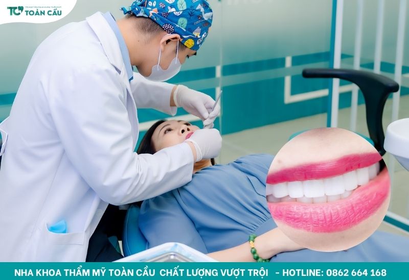 Răng bị nứt phải làm sao? 4 phương pháp khắc phục phổ biến 4 Bọc răng sứ tại Toàn Cầu