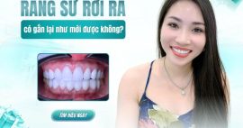 răng sứ rơi ra phải làm sao