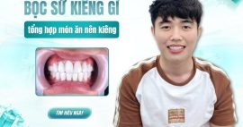 Những thực phẩm mới bọc sứ nên kiêng bạn nên biết