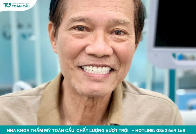 Sau khi trồng implant kiêng gì để vết thương mau lành? 5 Chú Long Implant