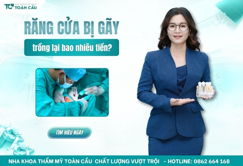 Trồng răng cửa bị gãy bao nhiêu tiền? Bảng giá làm răng 2025