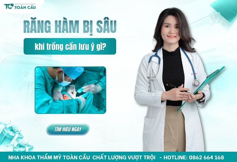 Trồng răng hàm bị sâu cần lưu ý gì?