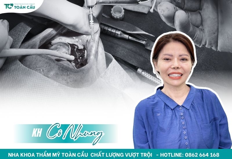 Trồng răng hàm bị sâu cần lưu ý gì? 8 Khách hàng trồng răng tại Nha khoa Thẩm mỹ Toàn Cầu