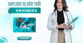 trụ Implant bị đào thải