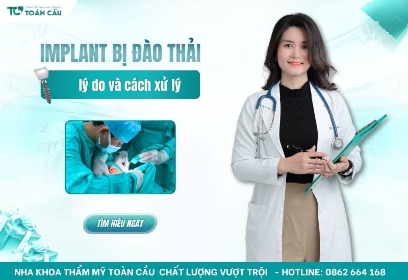 trụ Implant bị đào thải