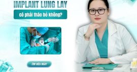 Trụ implant bị lung lay có phải tháo bỏ?