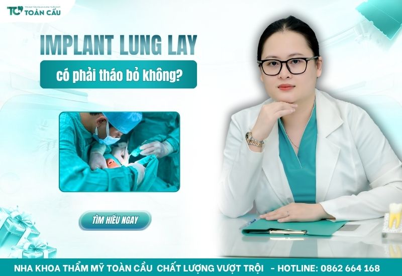 Trụ implant bị lung lay có phải tháo bỏ?