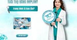 tuổi thọ trồng răng Implant