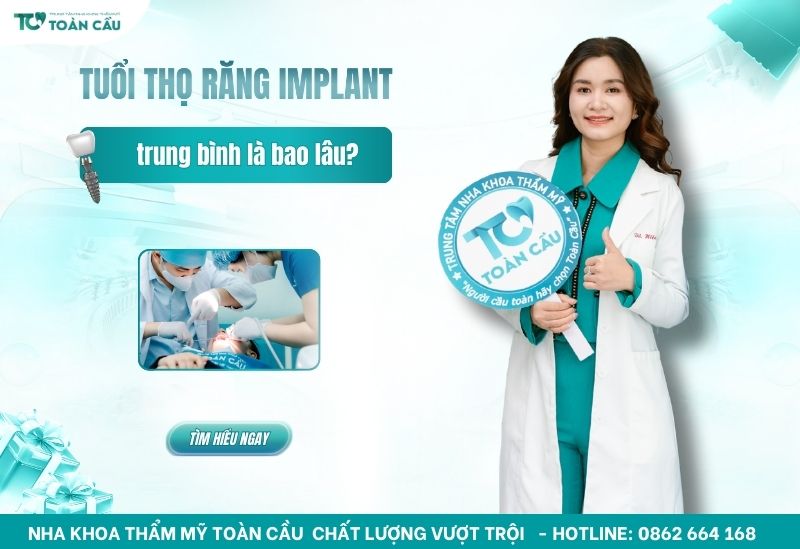 tuổi thọ trồng răng Implant