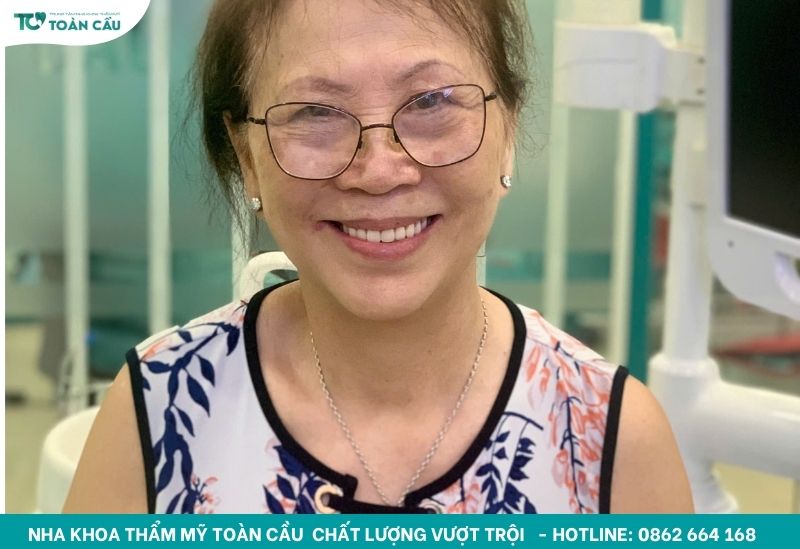 Tuổi thọ trồng răng implant trung bình là bao lâu? 6 Cô Phương - Khách hàng trồng Implant tại Toàn Cầu