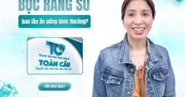 Bọc răng sứ bao lâu thì ăn uống bình thường?