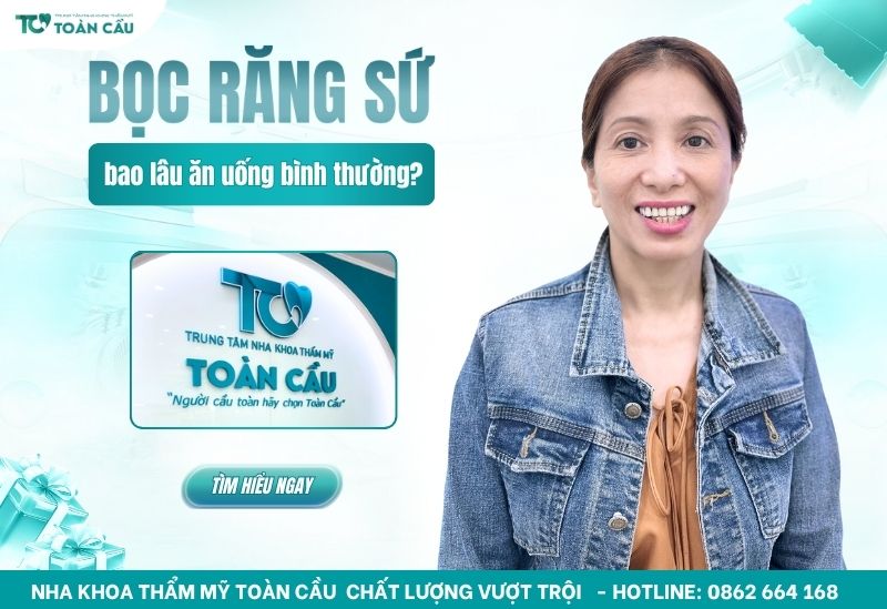 Bọc răng sứ bao lâu thì ăn uống bình thường?