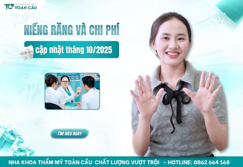 các loại niềng răng và chi phí