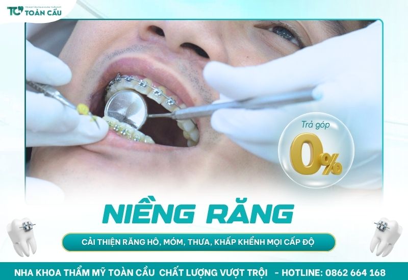Chương trình trả góp 0% lãi suất tại Toàn CầuChương trình trả góp 0% lãi suất tại Toàn Cầu