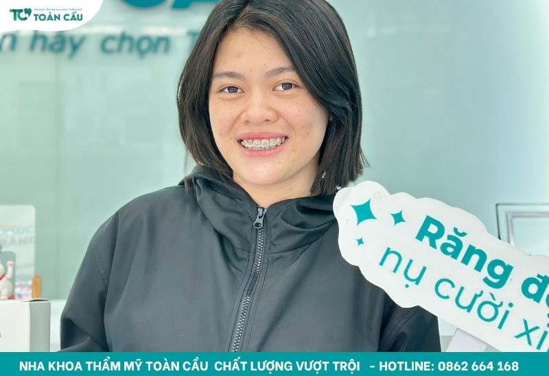 Khách tin chọn niềng răng tại Nha khoa Toàn Cầu