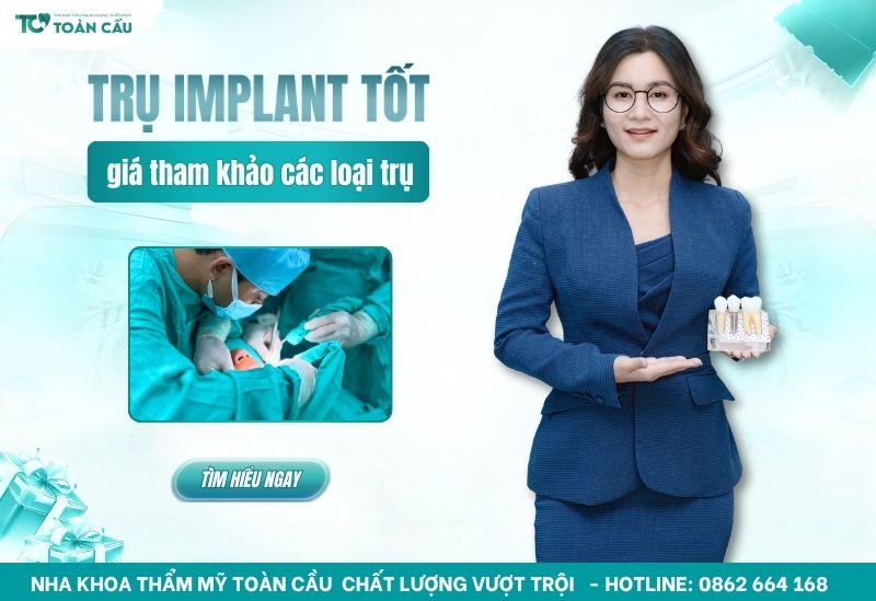 các loại trụ implant tốt