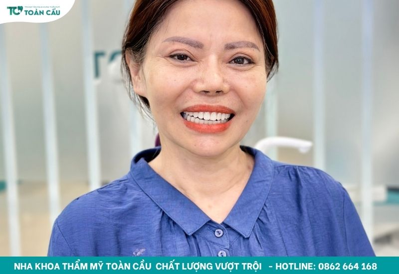 Implant là giải pháp bền vững