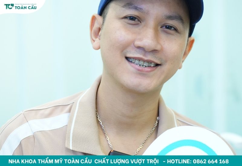 Cảm giác khi hôn người niềng răng có khác bình thường không? 5 Giữ mắc cài luôn sạch sẽ