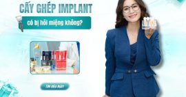 Giải đáp sau khi cấy implant có bị hôi miệng không